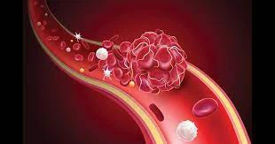 Blood-thinning effects Blood-thinning effects