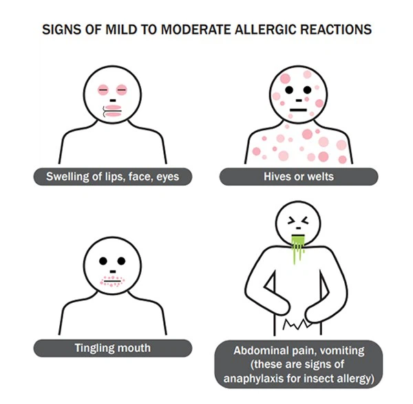Allergic reactions Allergic reactions