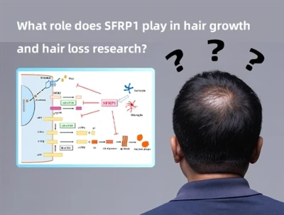 बालों के विकास और बालों के झड़ने के अनुसंधान में SFRP1 क्या भूमिका निभाता है