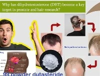प्रोस्टेट और बाल अनुसंधान में DHT एक प्रमुख लक्ष्य क्यों बन गया है?